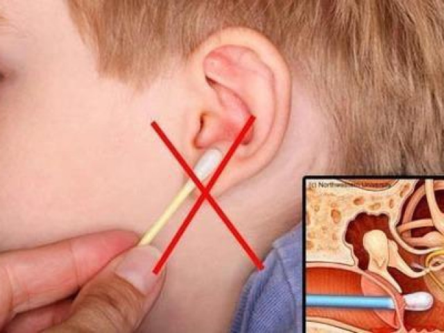 Sức khỏe đời sống - Những cách lấy ráy tai sai lầm có thể khiến bạn điếc vĩnh viễn