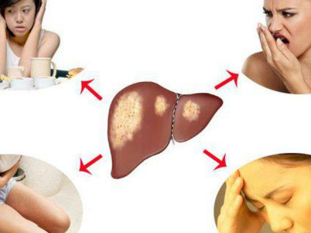 6 dấu hiệu cơ thể cảnh báo gan của bạn đang nhiễm độc, cần dừng ngay những thói quen này và thải độc cho gan