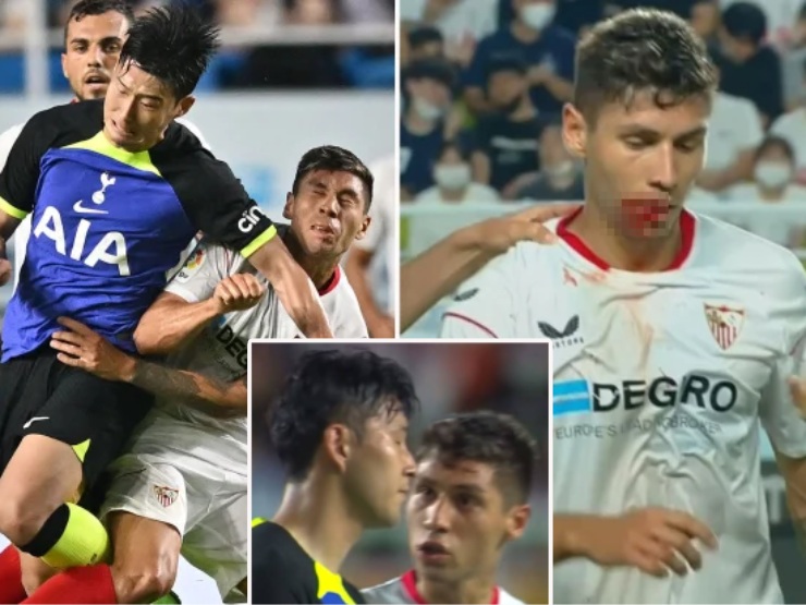 Bóng đá - Son Heung Min khiến đối thủ đổ máu miệng, trận của Tottenham suýt thành "võ đài"