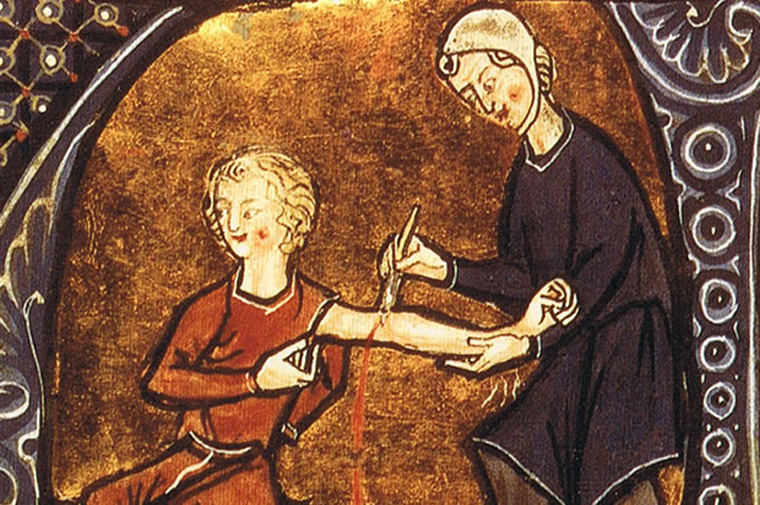 5 kỹ thuật y học kì lạ thời cổ đại, ai biết đến cũng thấy rùng mình - 1