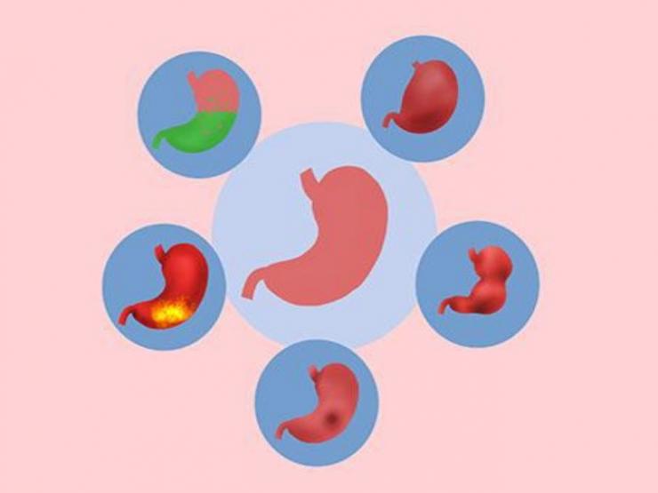 Sức khỏe đời sống - Thường xuyên chướng bụng dù ăn rất ít, có thể là dấu hiệu của những bệnh nguy hiểm này