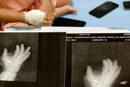 Pháp luật - Cháu bé 4 tuổi bị trúng đạn trong vụ nổ súng tại quán karaoke