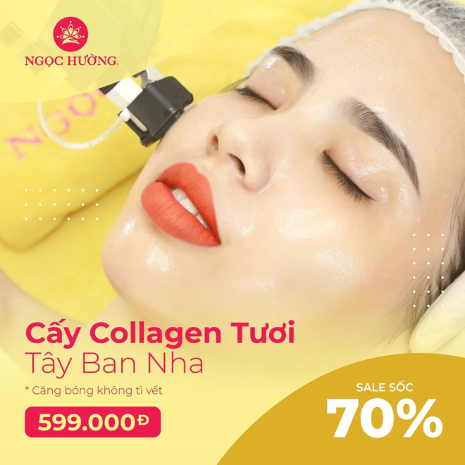 Chương trình Cấy collagen tươi ưu đãi siêu hấp dẫn tại Ngọc Hường