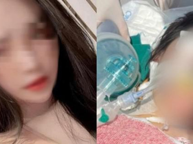 Vụ cô gái tử vong sau nâng mũi: Tạm đình chỉ công tác 1 bác sĩ Bệnh viện Ung bướu Hà Nội