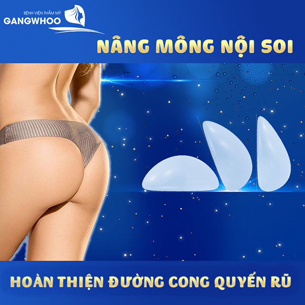 Lý do khách Việt Kiều ưa chuộng công nghệ nâng mông tại Gangwhoo - 2