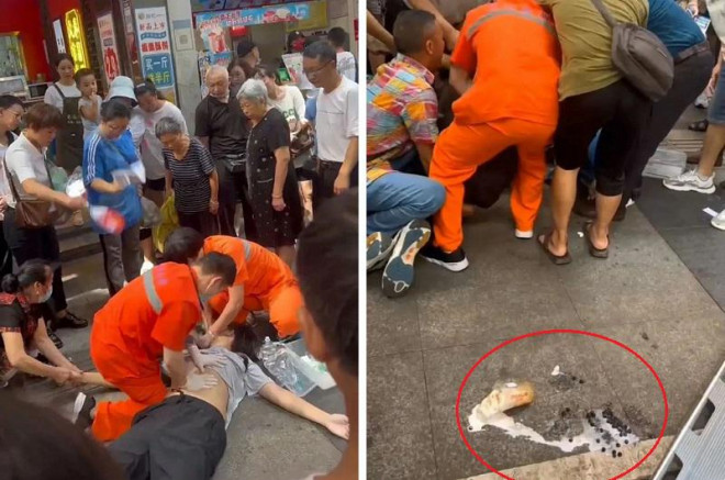 Các nhân viên y tế sơ cứu cho thiếu niên bị hóc trân châu khi uống trà sữa. Ảnh: Thời báo Hoàn Cầu