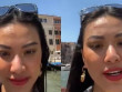 Dù là Á hậu Siêu quốc gia, Kim Duyên vẫn không né được mụn: Nguyên nhân do đâu?