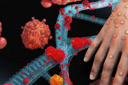 Sức khỏe đời sống - Bệnh đậu mùa khỉ: Ai dễ nhiễm và dễ bị bệnh nặng?