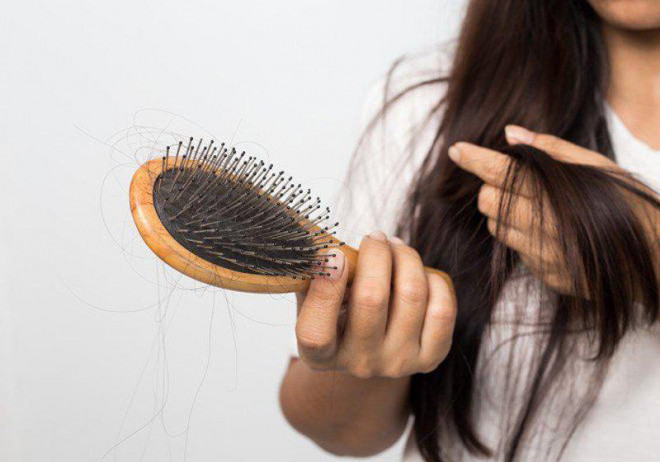 Rụng tóc gây nhiều lo lắng cho phụ nữ.