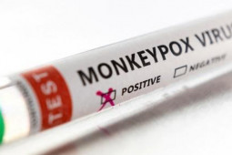 Sức khỏe đời sống - Làm thế nào để giảm nguy cơ mắc bệnh đậu mùa khỉ khi quan hệ tình dục?