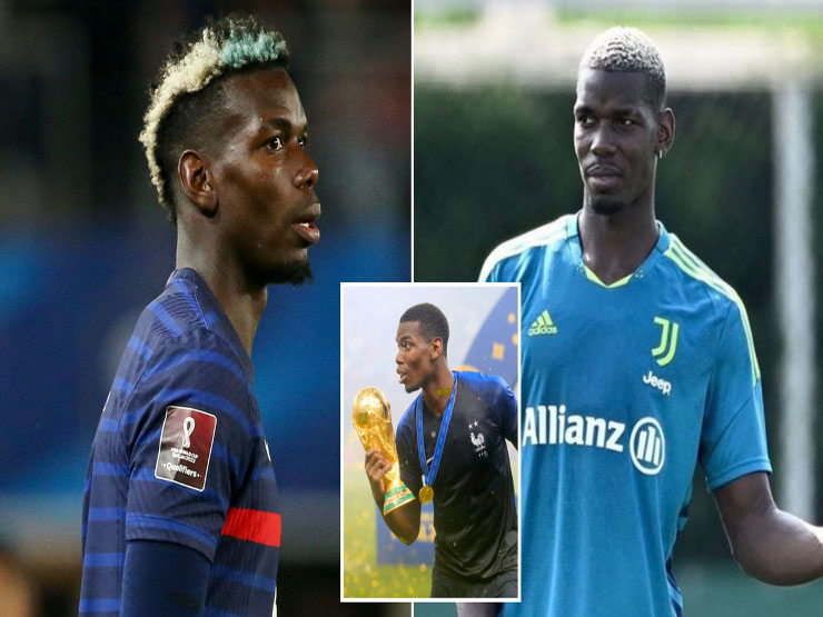 Bóng đá - Tin mới nhất bóng đá tối 3/8: Pogba từ chối phẫu thuật vì World Cup 2022