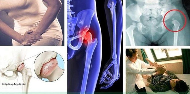 Đau nhức háng tận trong xương cần phải làm ngay điều này! - 1