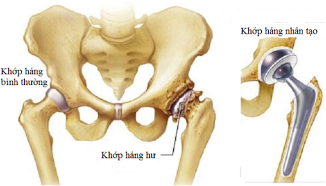 Đau nhức háng tận trong xương cần phải làm ngay điều này! - 3