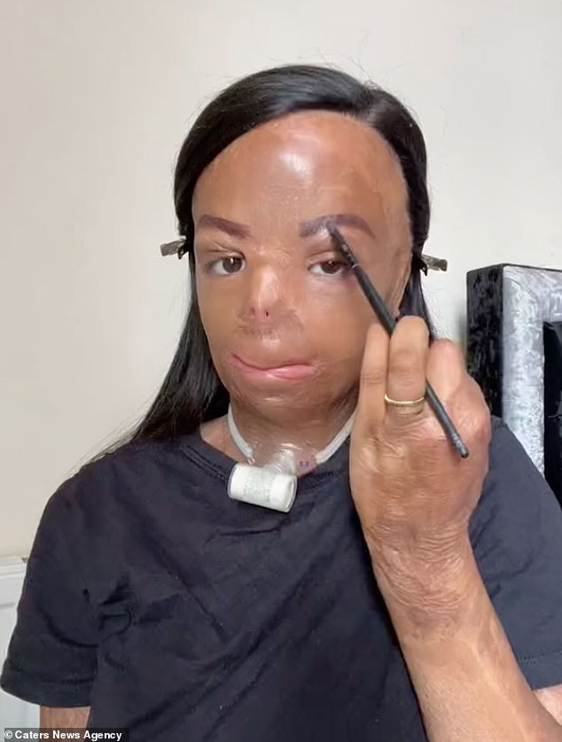 Aleema đã cố gắng tiếp tục cuộc sống của mình và hiện đang phát triển mạnh mẽ sự tự tin