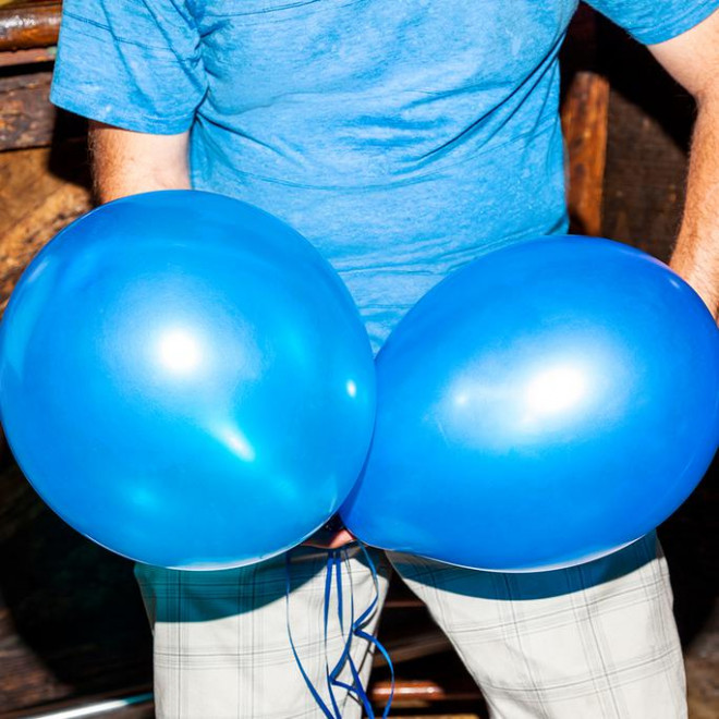 Cần đến bác sĩ để được tư vấn và điều trị khi tinh hoàn chuyển sang màu xanh dương - Ảnh: Cosmopolitan.