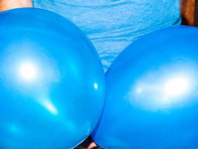 Sức khỏe đời sống - Cẩn thận khi tinh hoàn chuyển màu