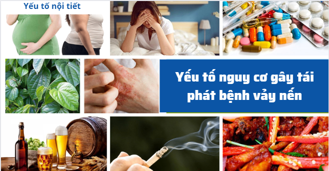 Hệ miễn dịch dễ bị kích hoạt với các yếu tố nguy cơ khiến bệnh vảy nến hay tái phát