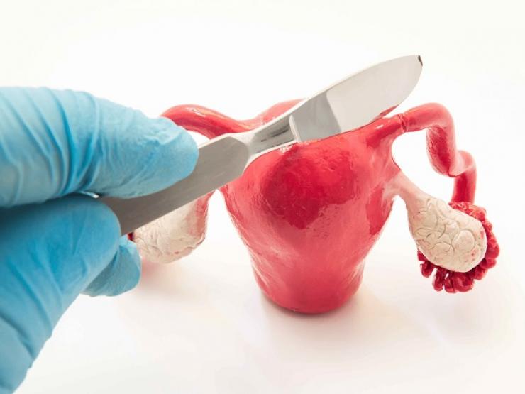 Sức khỏe đời sống - Những hành vi âm thầm phá hoại tử cung, phụ nữ nên biết để tránh xa