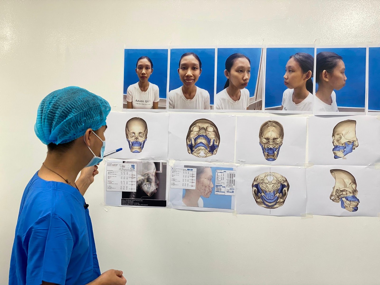 Khoa Răng Hàm Mặt ứng dụng công nghệ AI mang đến giải pháp tối ưu.