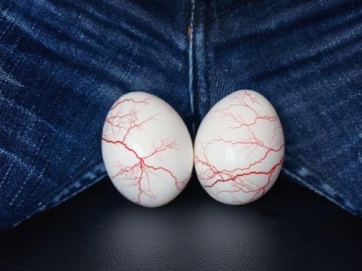 Sức khỏe đời sống - Quý ông hết sức cẩn trọng nếu thấy mạch máu nổi chằng chịt ở vị trí nhạy cảm này