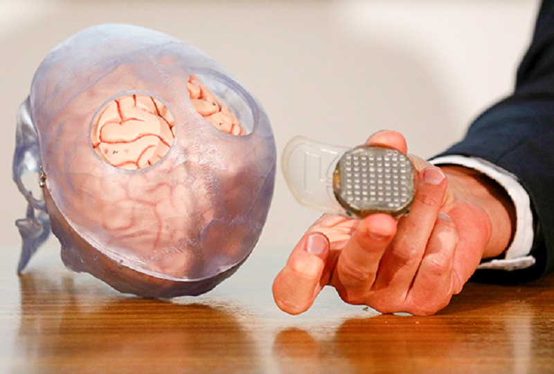 Kết nối với Web 4.0 có thể đòi hỏi phải phẫu thuật thần kinh.