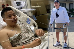 Đời sống Showbiz - Tình hình Khoa Pug sau 1 tháng "biệt tăm" vì kéo dài chân lên 1m75