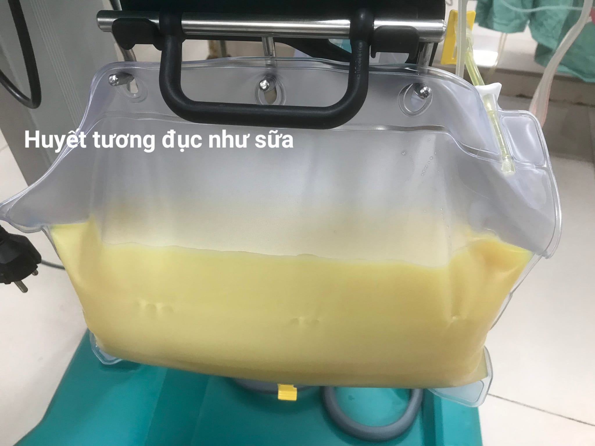 Huyết tương của bệnh nhân màu trắng đục như sữa.