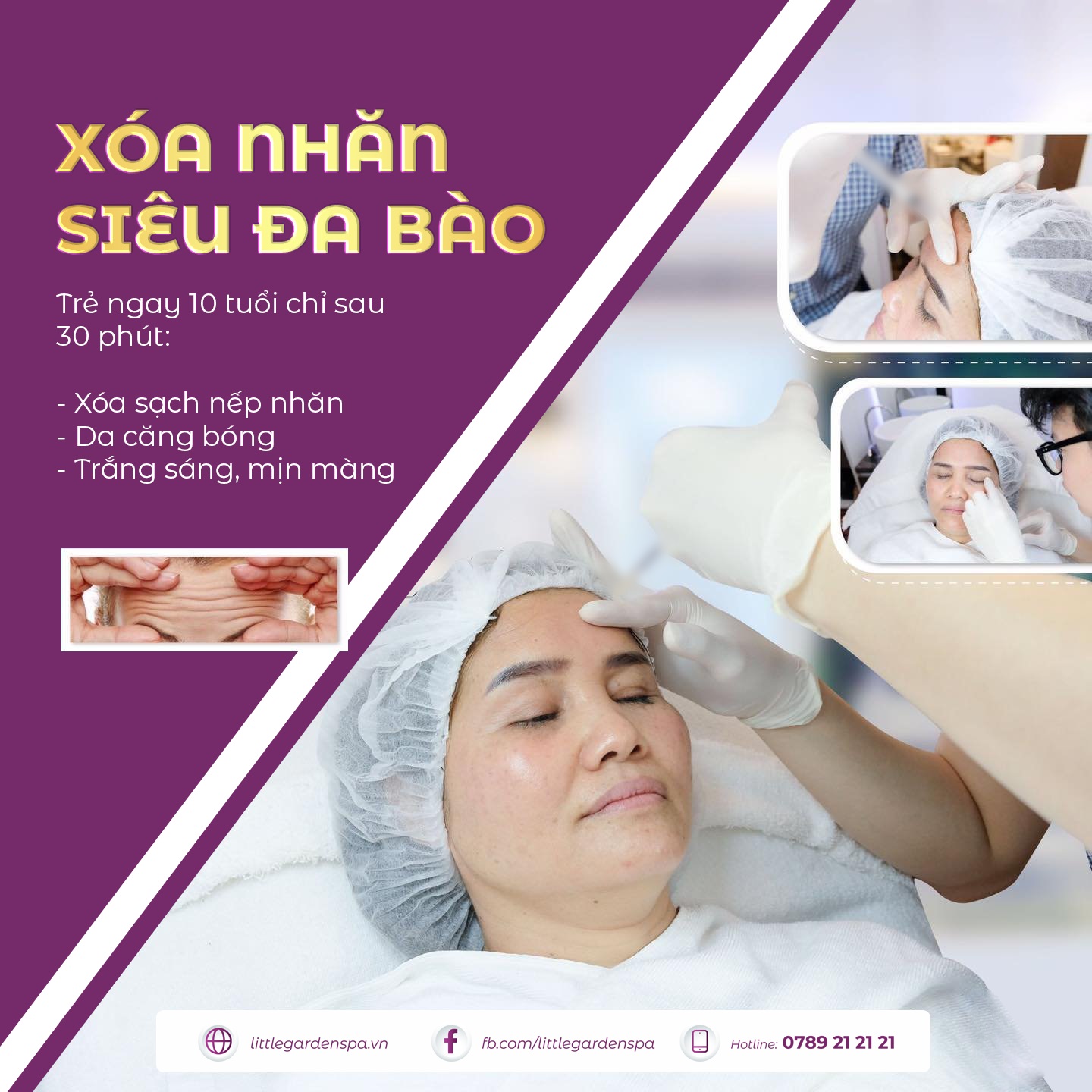 Tìm lại thanh xuân “ngay và luôn” bằng công nghệ xóa nhăn siêu đa bào - 1