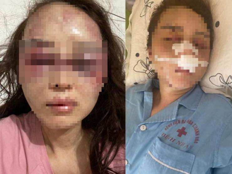 Tin tức trong ngày - Tin tức 24h qua: Nguyên nhân cán bộ QLTT ở Thanh Hóa đánh đập bạn gái dã man