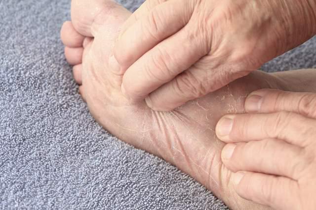 Có 4 dấu hiệu bất thường ở bàn chân, không phải lão hóa mà là những dấu hiệu của bệnh nguy hiểm - 1