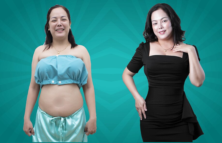 Chị Ngọc Duyên khác biệt trước và sau khi hút mỡ