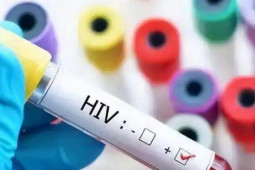 Bạn trẻ - Cuộc sống - Thanh niên suy sụp vì xét nghiệm dương tính với HIV, 5 năm sau phát hiện sự thật gây sốc