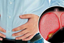 Sức khỏe đời sống - Cảnh báo: Ngoài béo phì, 7 lý do này cũng có thể khiến gan nhiễm mỡ