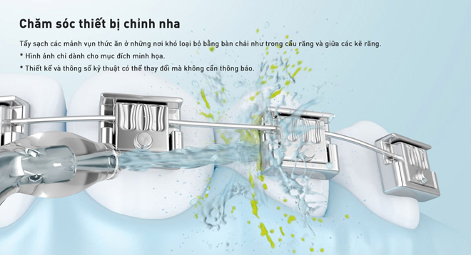 Hiệu quả làm sạch của tia nước siêu âm tốt hơn tia nước thông thường với cùng một mức áp lực nước, hạn chế việc phải dùng áp lực nước mạnh gây tổn thương nướu.