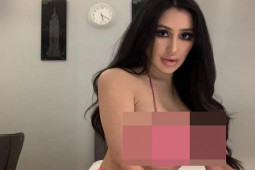 Người phụ nữ Hàn Quốc phẫu thuật 15 lần để thành bản sao Kim Kardashian