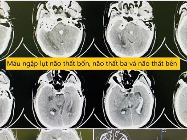 Sức khỏe đời sống - Đang ngồi làm việc, người đàn ông bất ngờ gục xuống