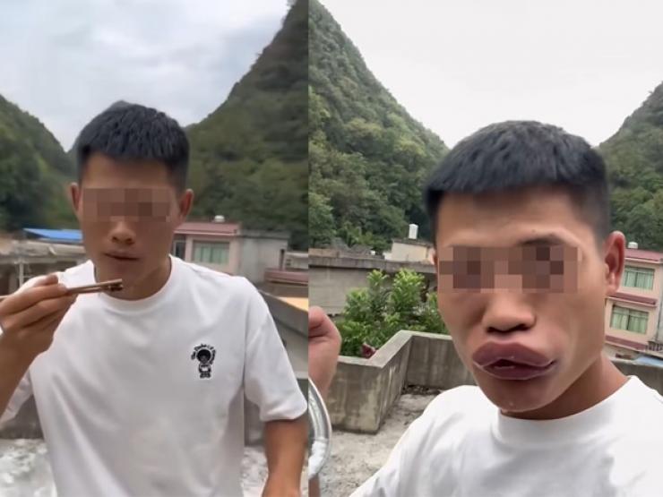 Bạn trẻ - Cuộc sống - Clip: Anh chàng “câu view” ăn sống ong nhận cái kết đầy đau đớn