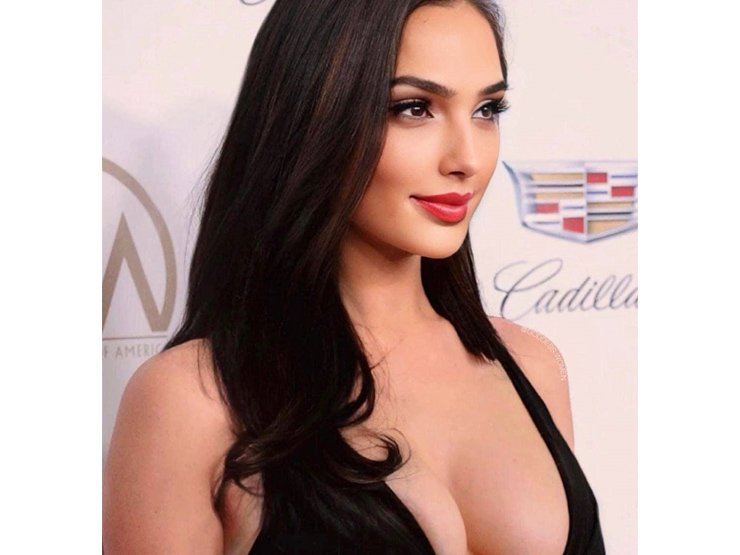 Làm đẹp - "Mỹ nhân đẹp nhất Trung Đông" gây tranh cãi vì vóc dáng thất thường