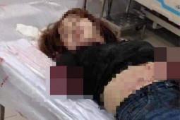 Lời khai ban đầu của người chồng chém lìa 2 cánh tay vợ