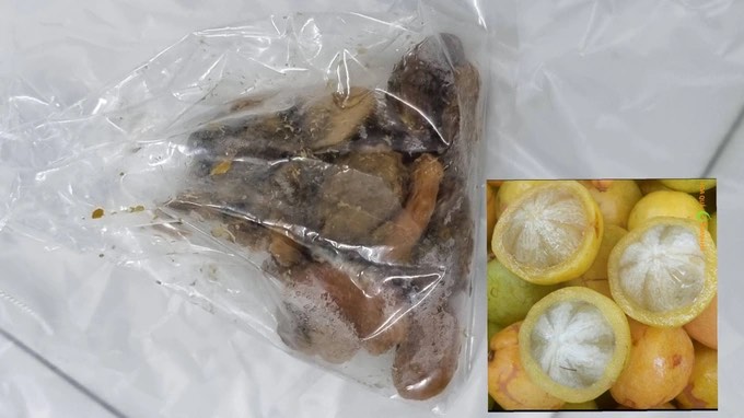 Hình ảnh hạt quả bứa được lấy ra từ bụng người bệnh (Ảnh:BVCC).