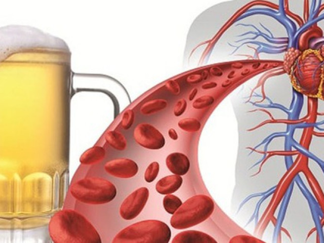 Sức khỏe đời sống - Vì sao rượu bia là "kẻ thù" với người bệnh tăng huyết áp?