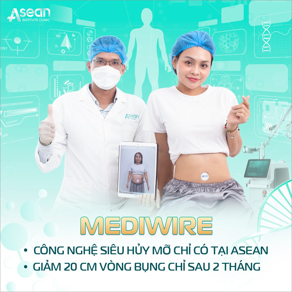 Dịch vụ giảm béo Mediwire tại Thẩm mỹ Quốc tế Asean có gì đặc biệt? - 2