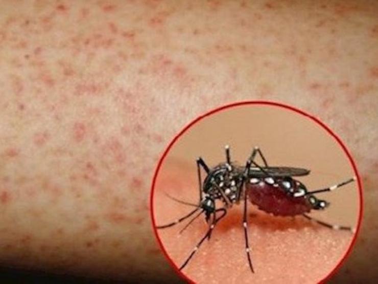 Sức khỏe đời sống - Đã có hơn 200 nghìn ca mắc sốt xuất huyết, 87 ca tử vong