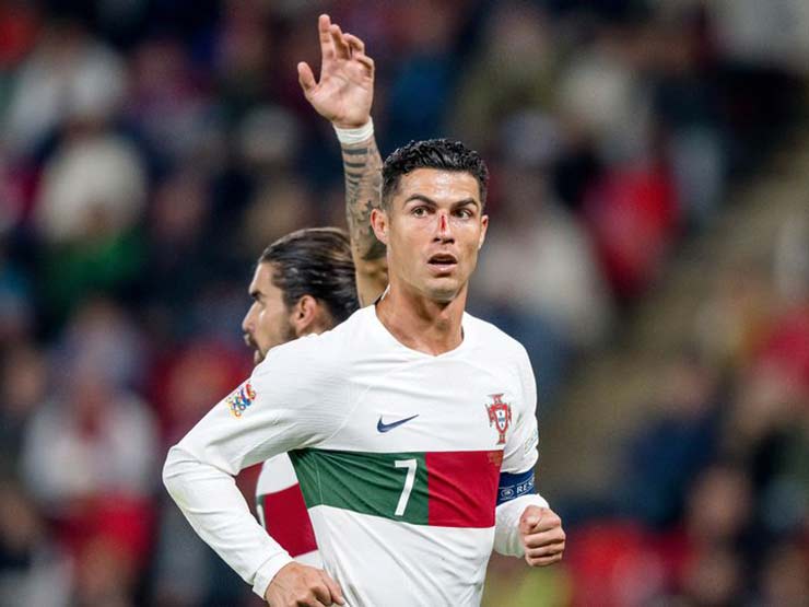 Bóng đá - Ronaldo chảy máu mũi &amp; đau mắt cá, MU lo mất hết tiền đạo đấu Man City