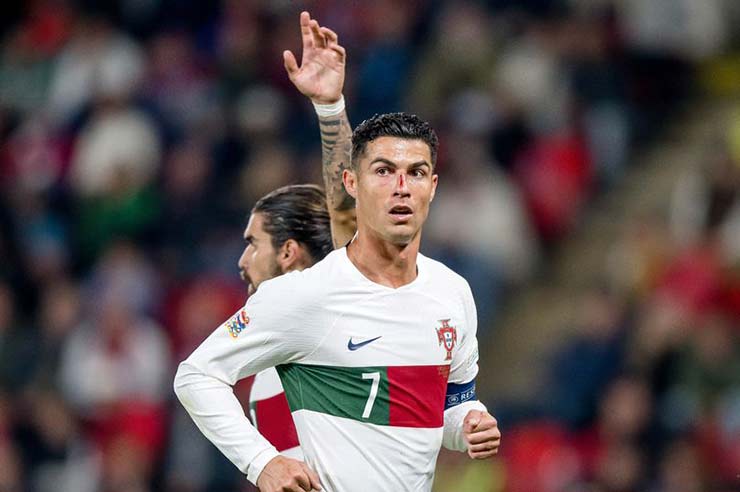 Ronaldo đổ máu trong trận thắng CH Czech của Bồ Đào Nha