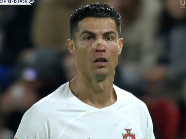 Bóng đá - Ronaldo bất ngờ đen đủ đường: Đổ máu từ rất sớm, suýt sắm vai "tội đồ"