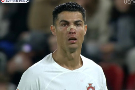 Ronaldo bất ngờ đen đủ đường: Đổ máu từ rất sớm, suýt sắm vai "tội đồ"
