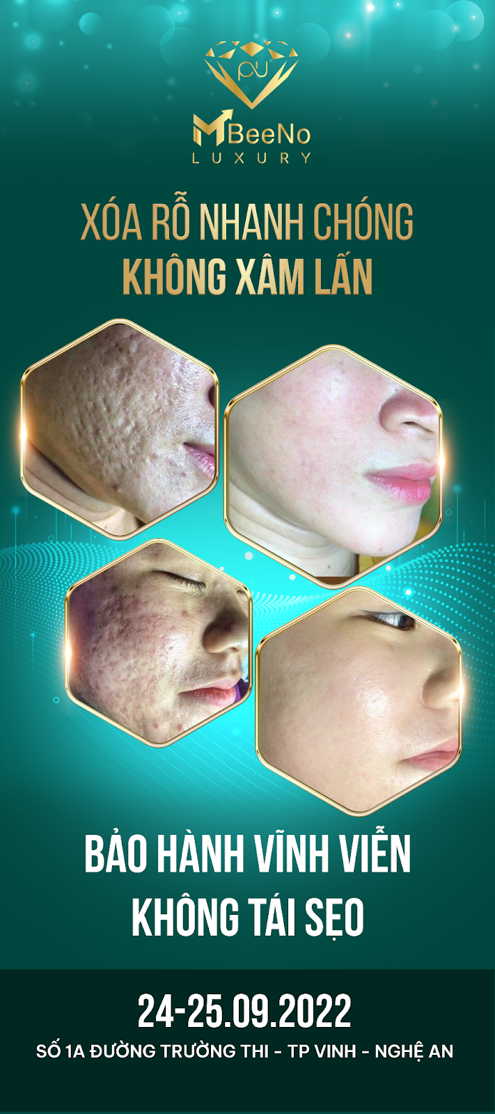 Công nghệ mới của MBEENO Group