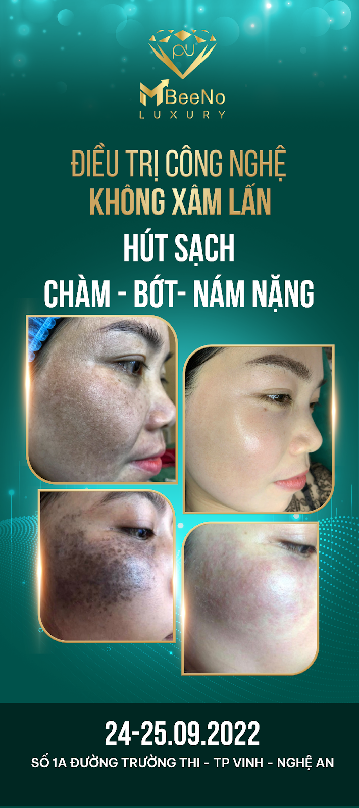 CEO của MBEENO - Nhất Chi Mai rạng rỡ trong buổi chuyển giao công nghệ mới - 3