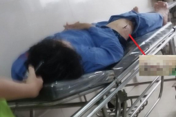 Pháp luật - Cán bộ Cục Thuế Ninh Bình phản bác lời khai của kẻ dùng dao đâm mình